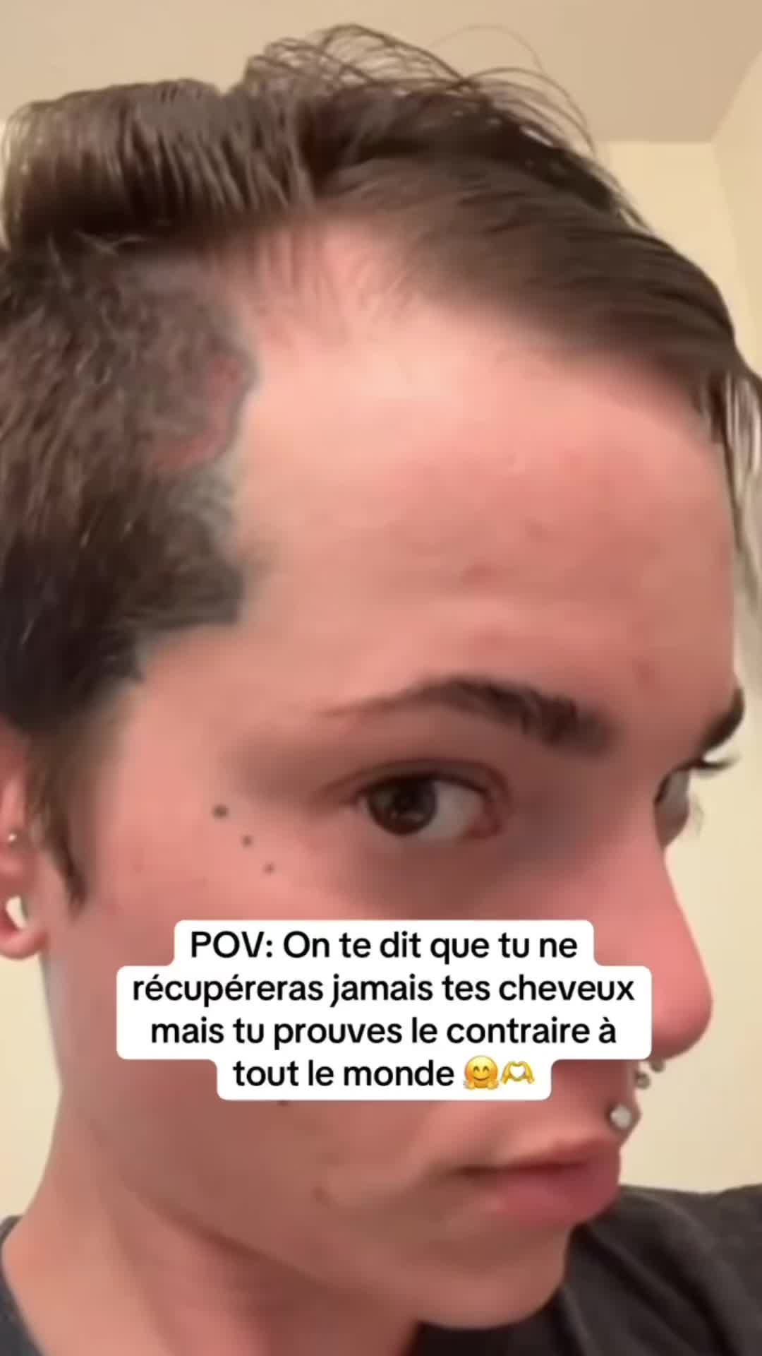@Lux’Hair Growth