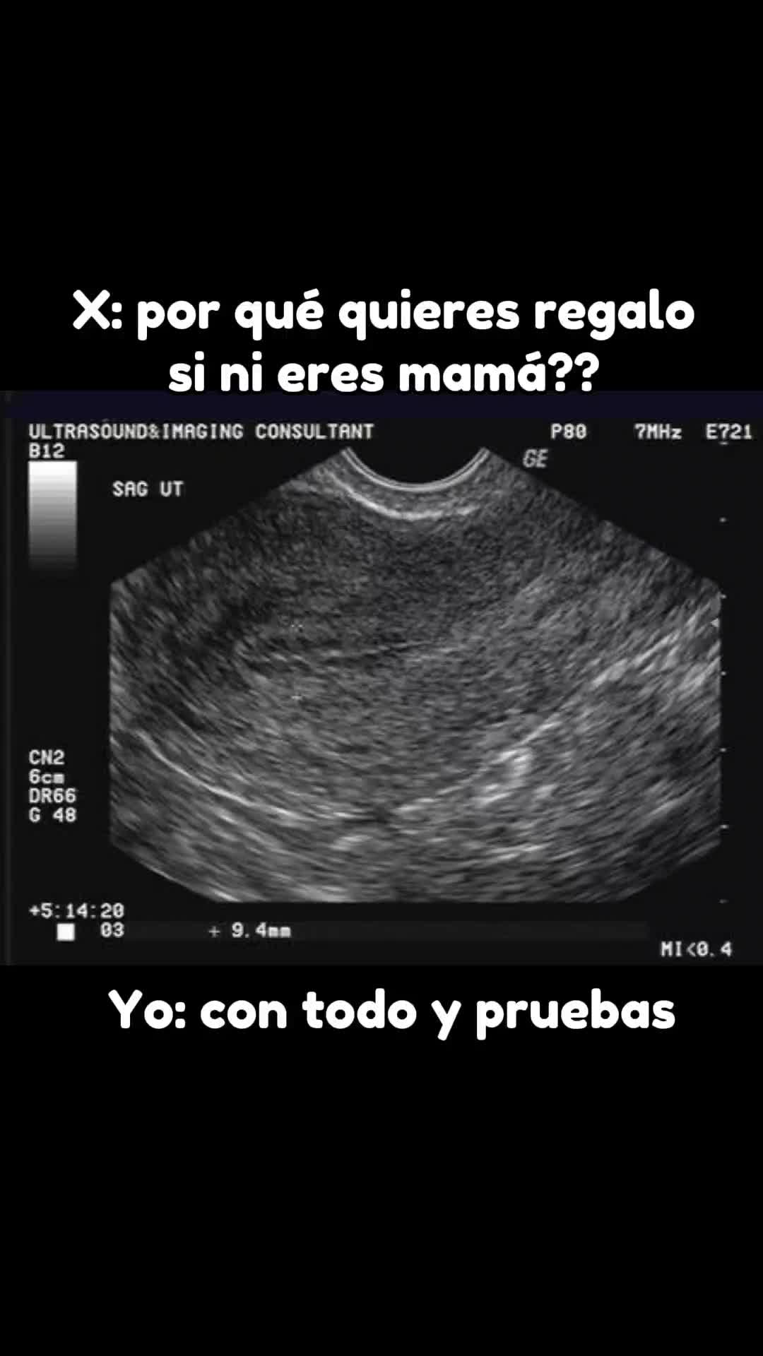 @VeteAlv