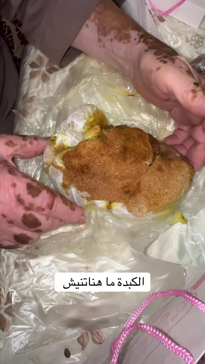 @Molat lbalbola