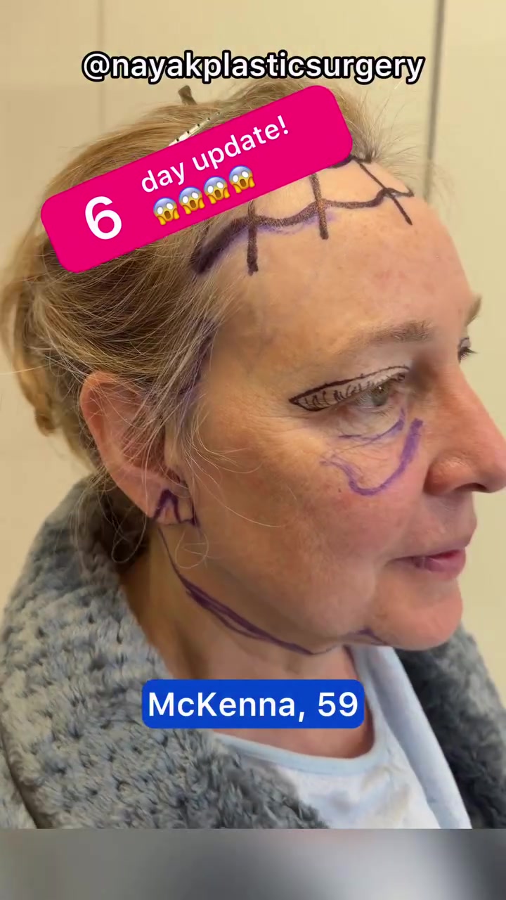 @NayakPlasticSurgery