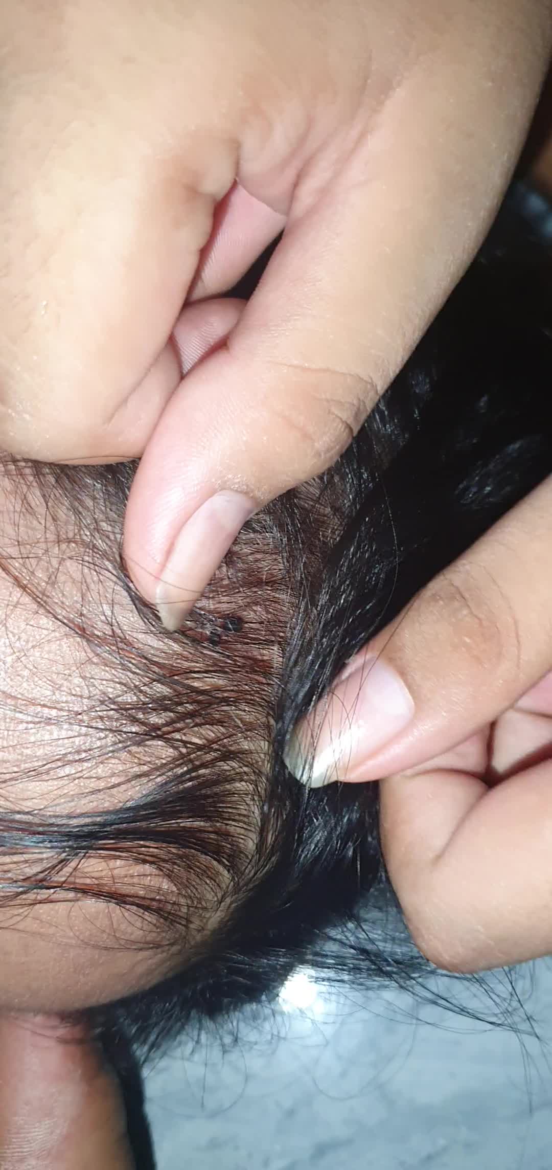 @LICE - TICKS