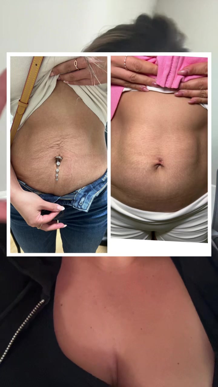 @Christy - NWI Aesthetic NP