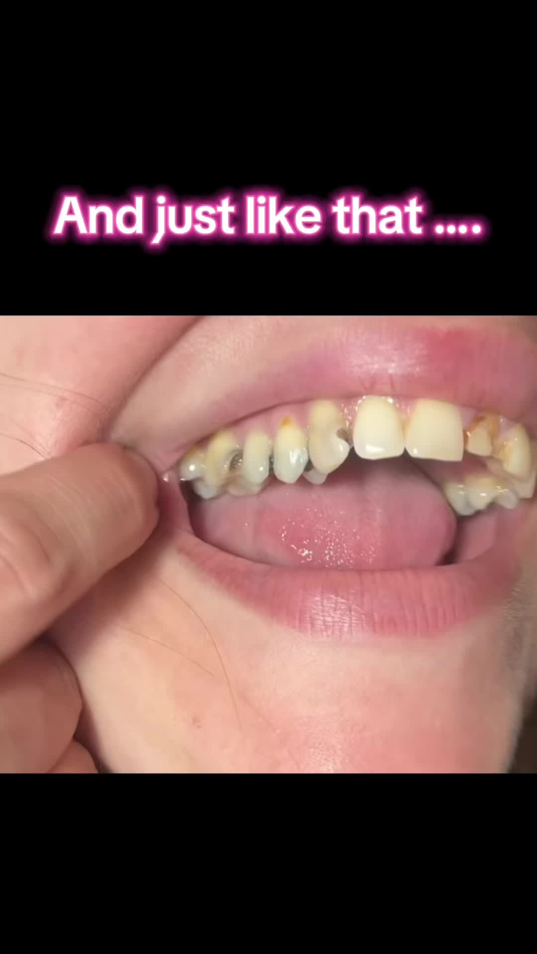 @TruthInMyTeeth