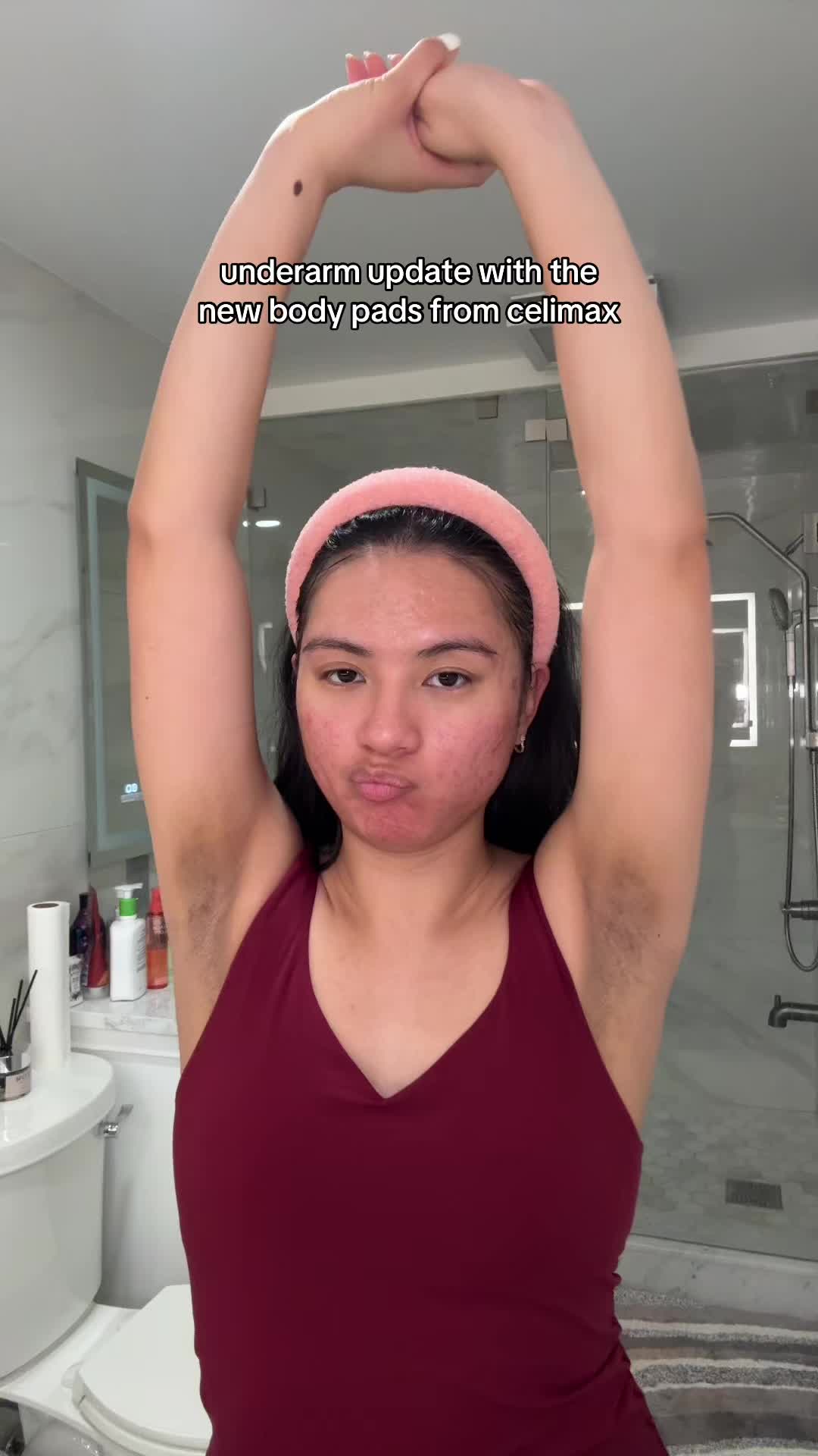 @jennilee &bull; thatacnegirlie