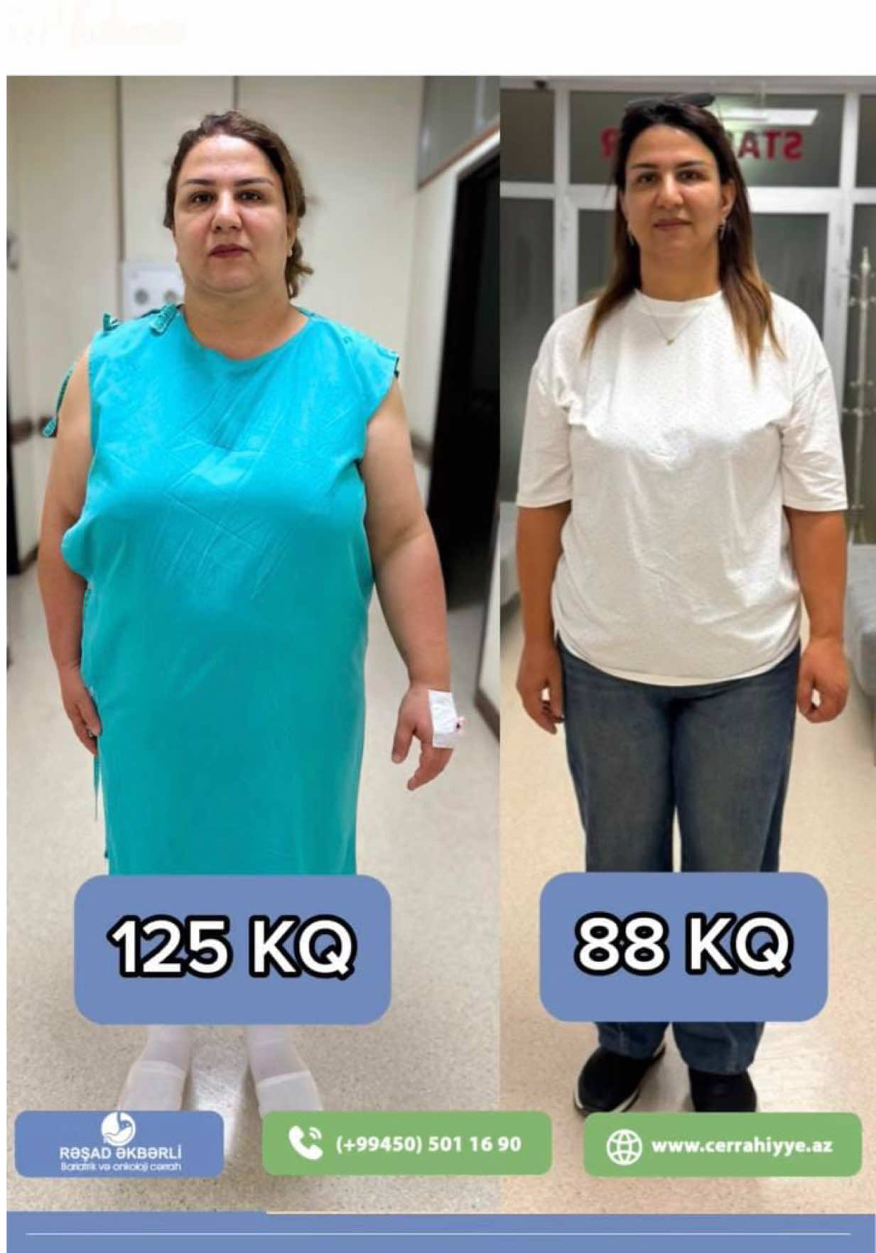 @Ümumi Cərrah Rəşad Əkbərli