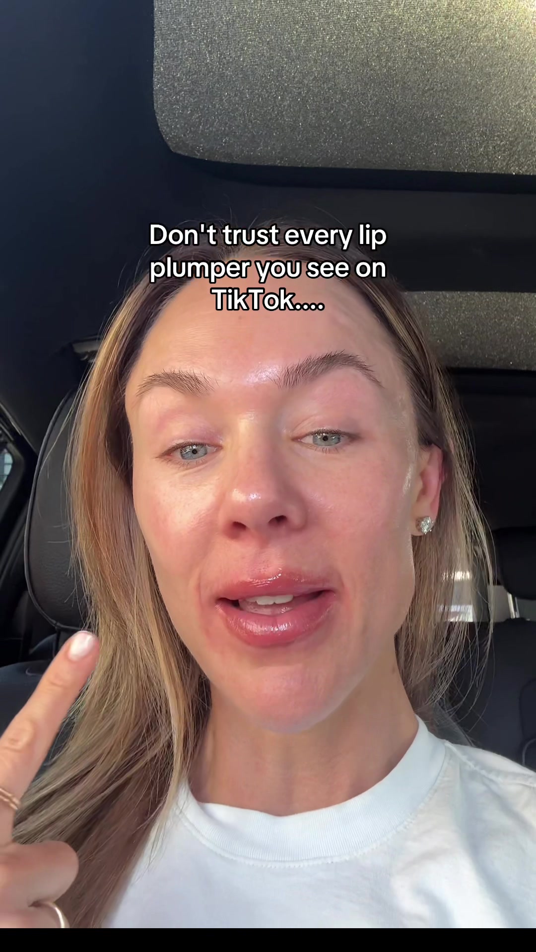 @Celeste | RN acne expert