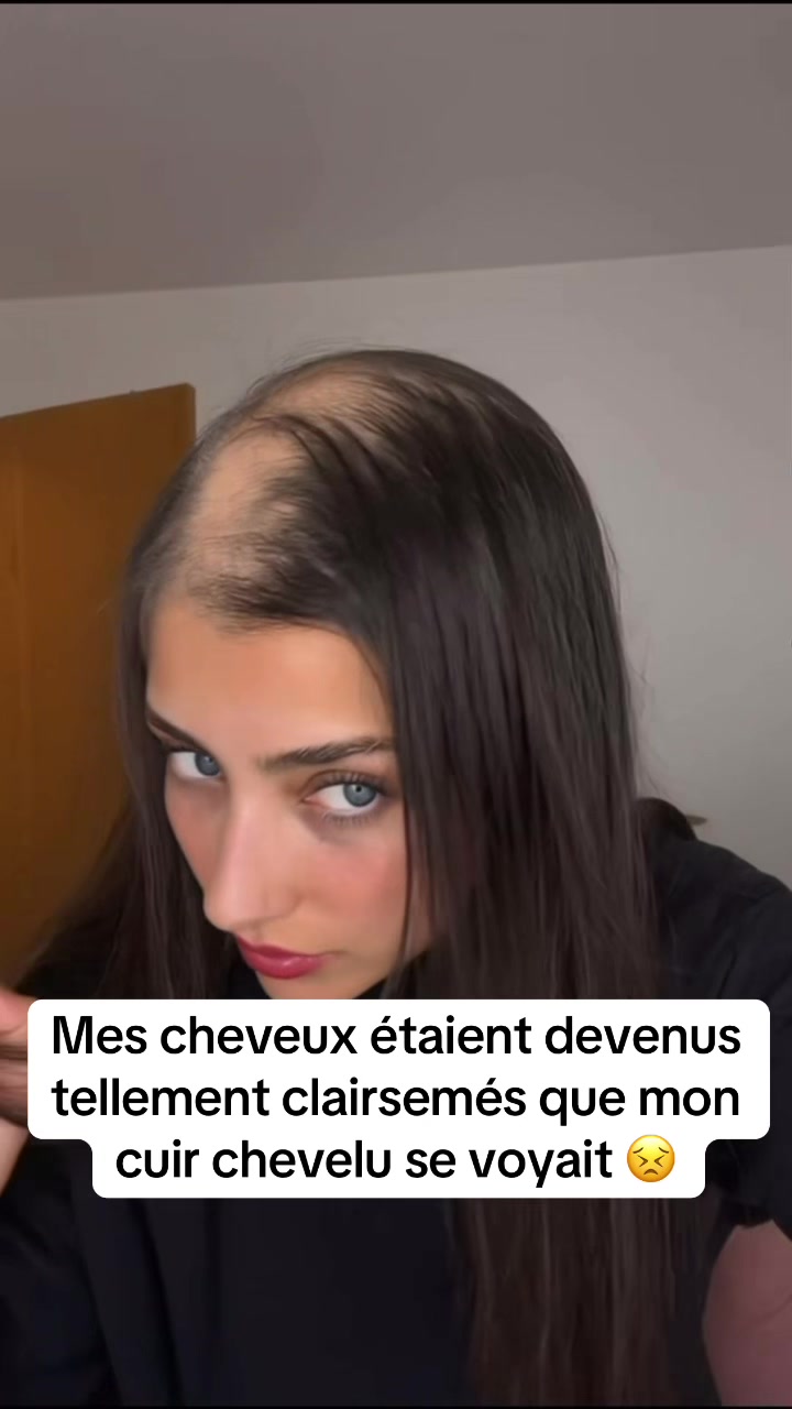 @Lux’Hair Growth