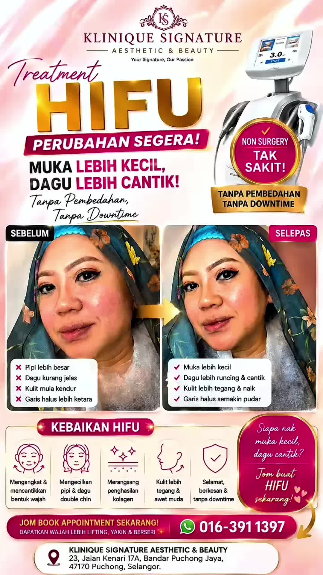@bilakakelieyreview