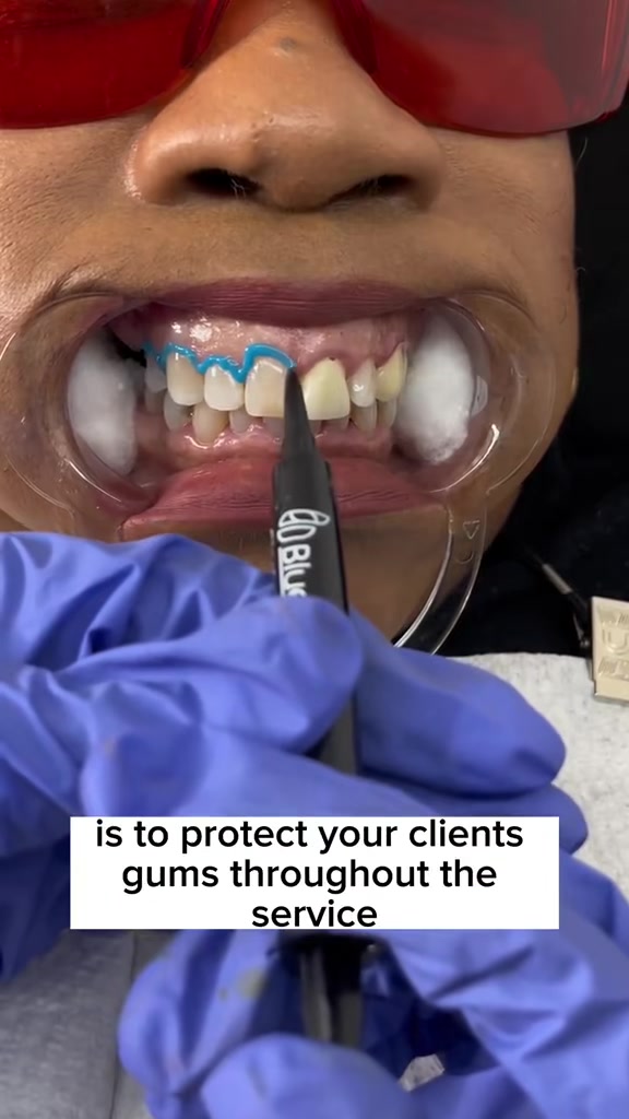 @Diandra | Teeth Whitening Tech