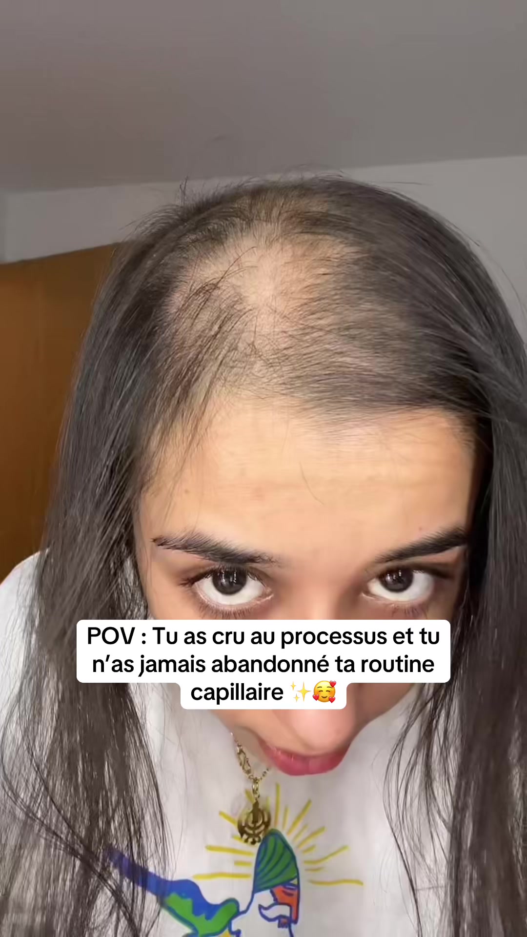 @Lux’Hair Growth