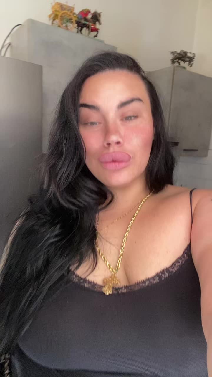 @Alessia albino