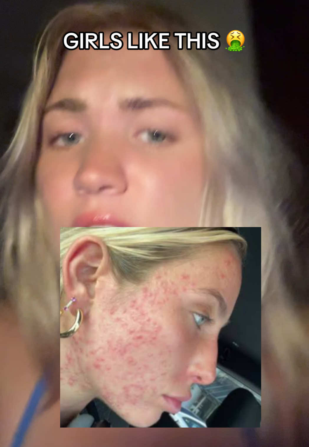 @bellytts