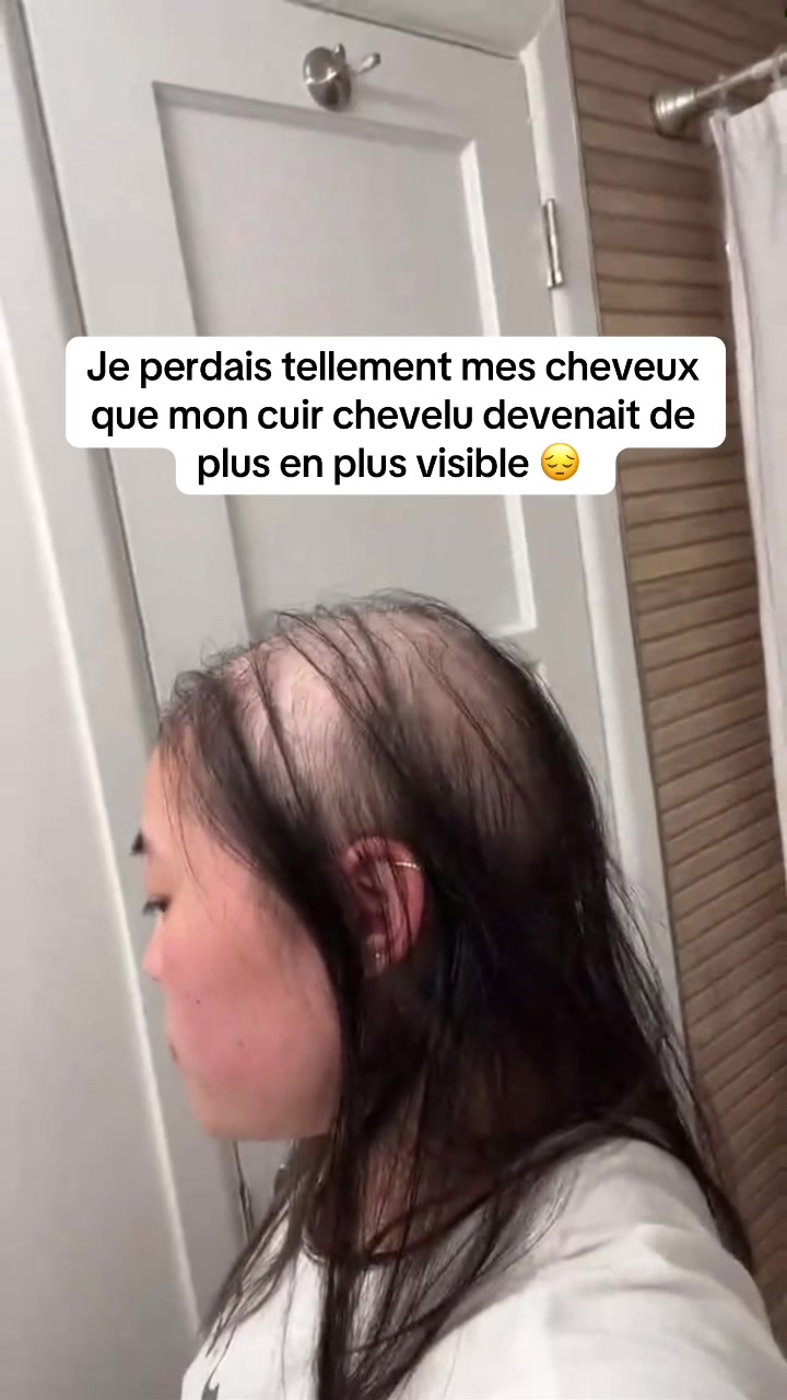 @Lux&rsquo;Hair Growth