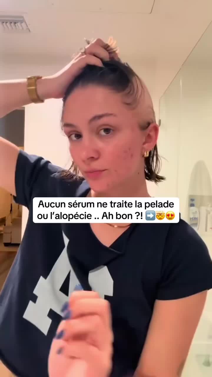 @Lux’Hair Growth