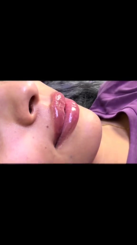 @cosmetolog.Ilaha🇹🇲🇦🇿