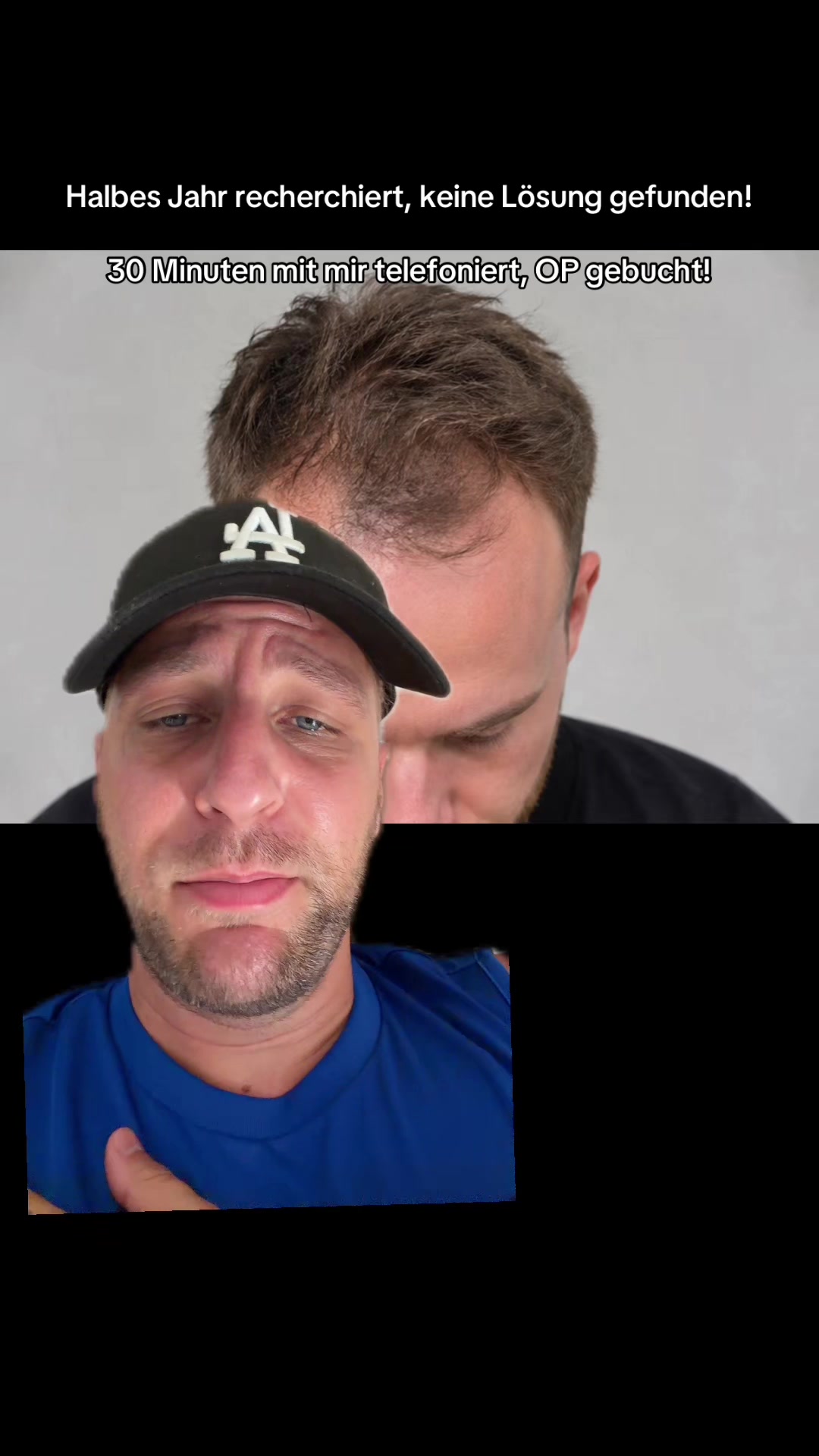 @Mr. Hairtransplant