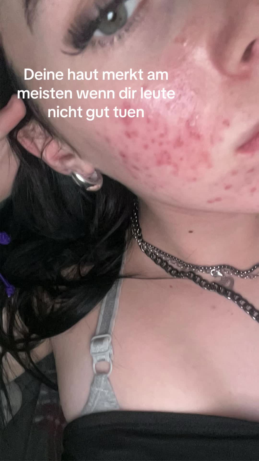 @65454