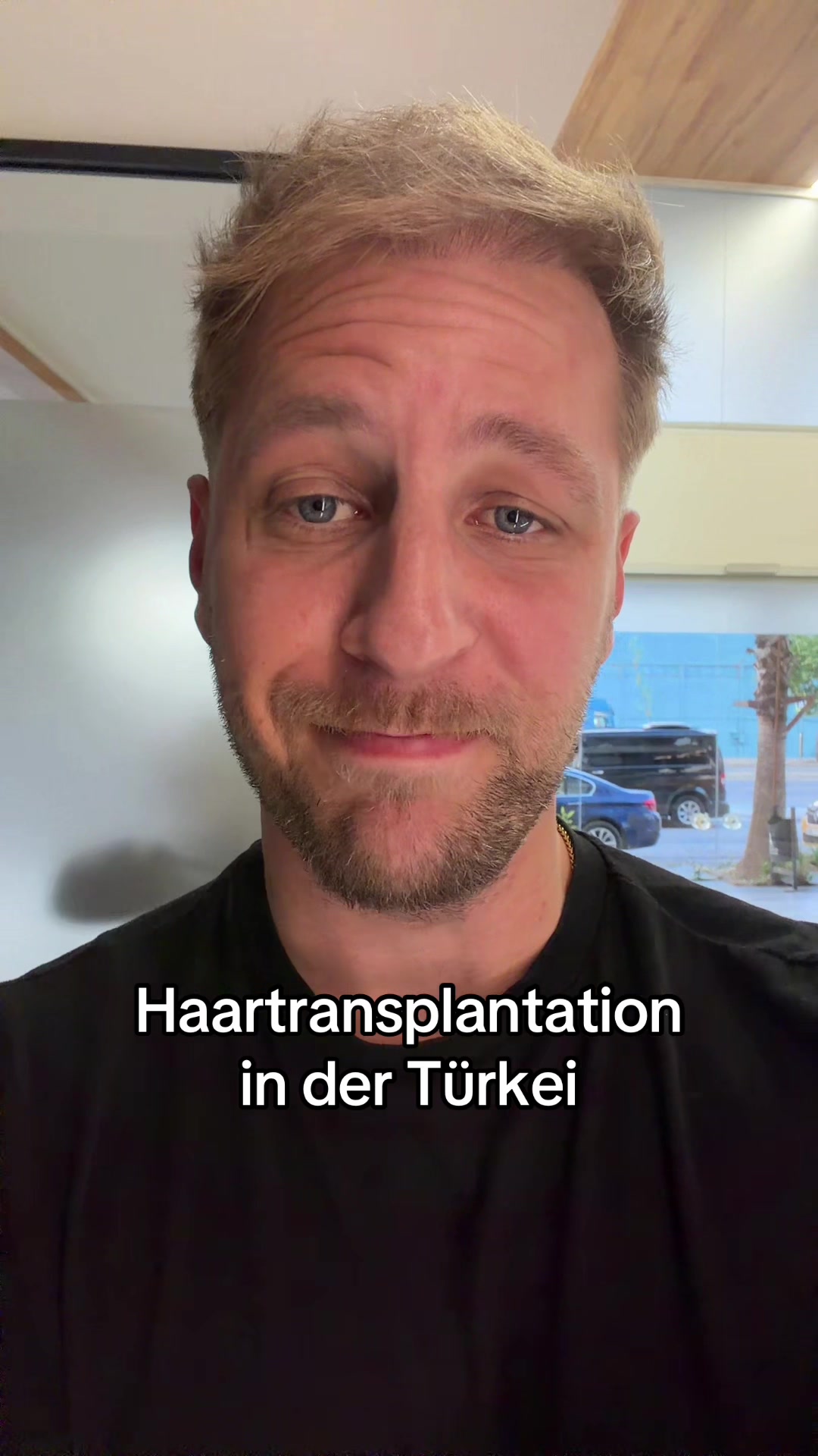 @Mr. Hairtransplant