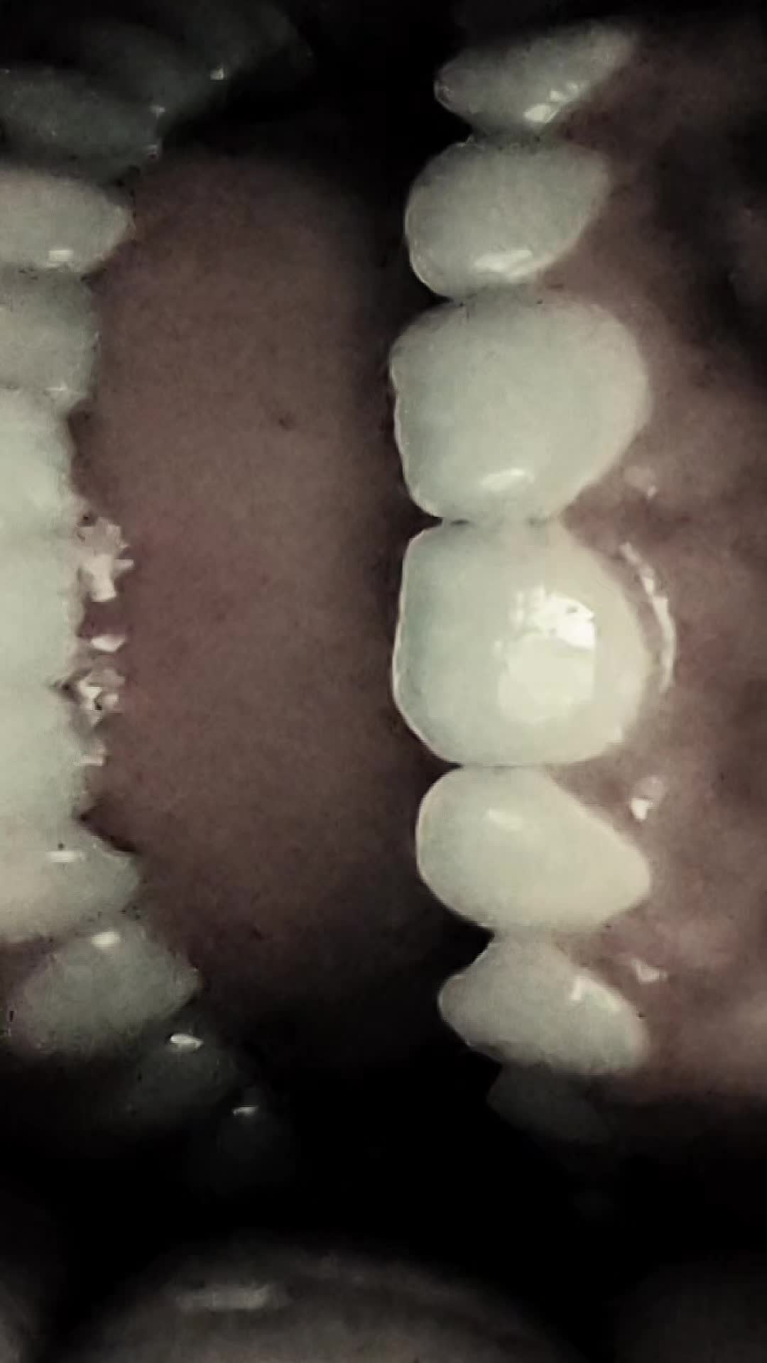 @JunkyTeeth