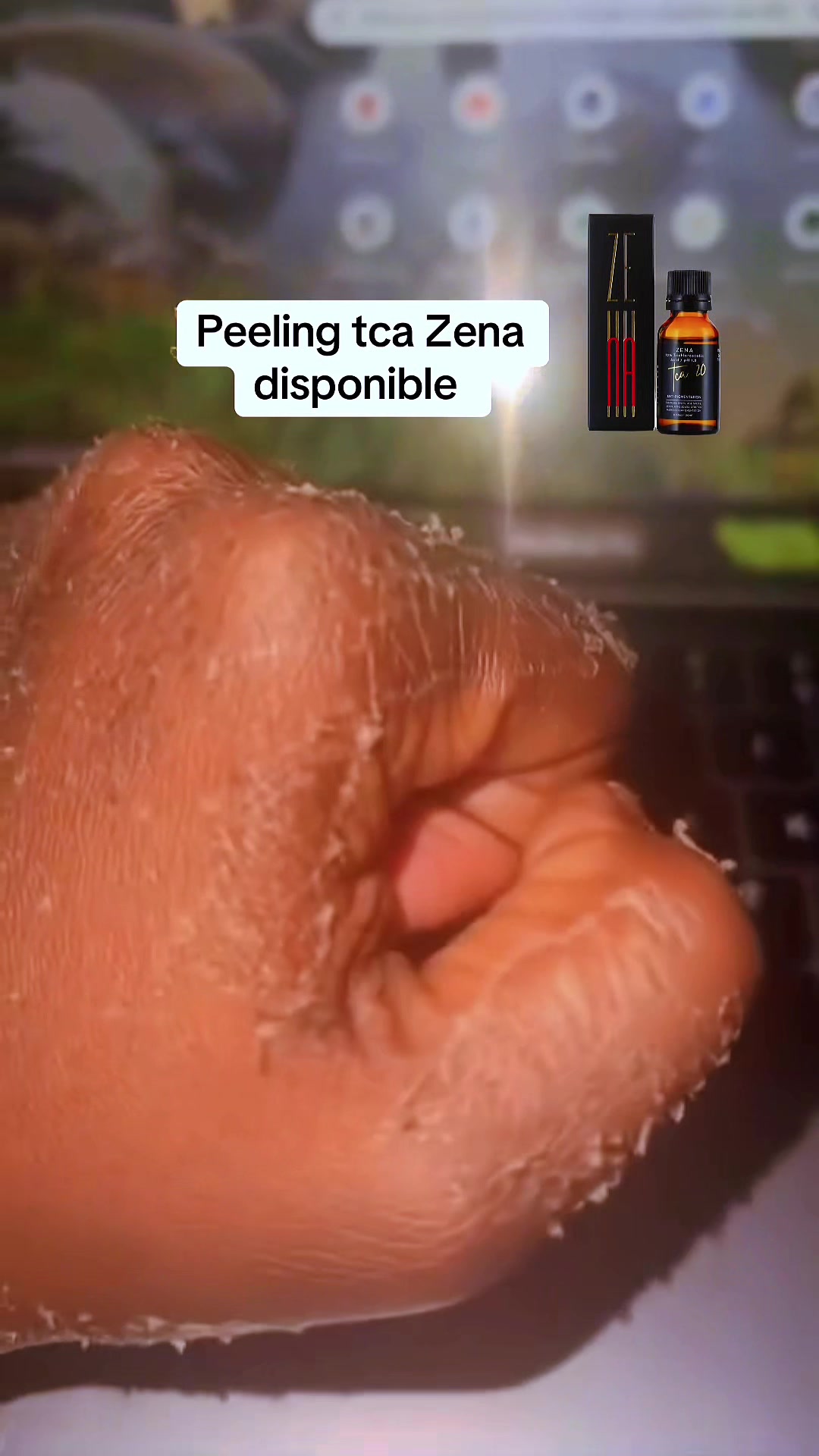 @peeling_zena