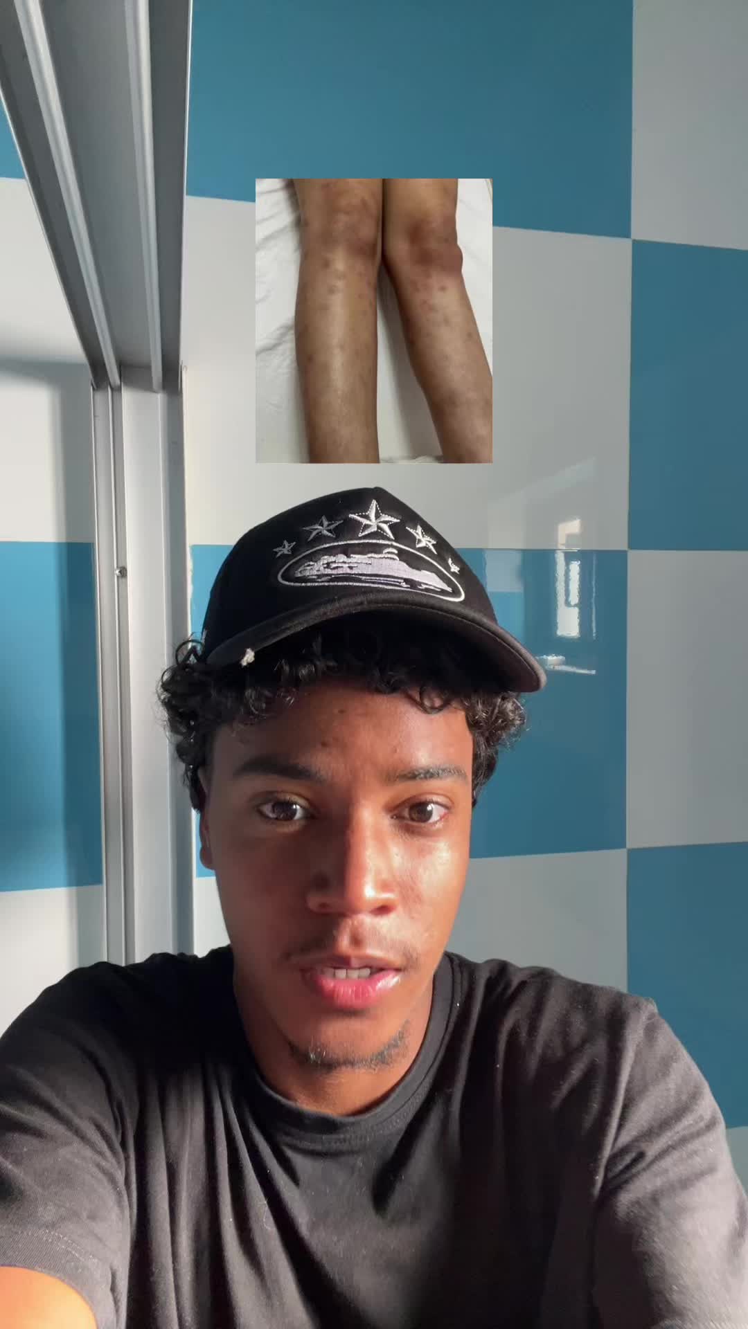 @V A N D I 🇨🇻