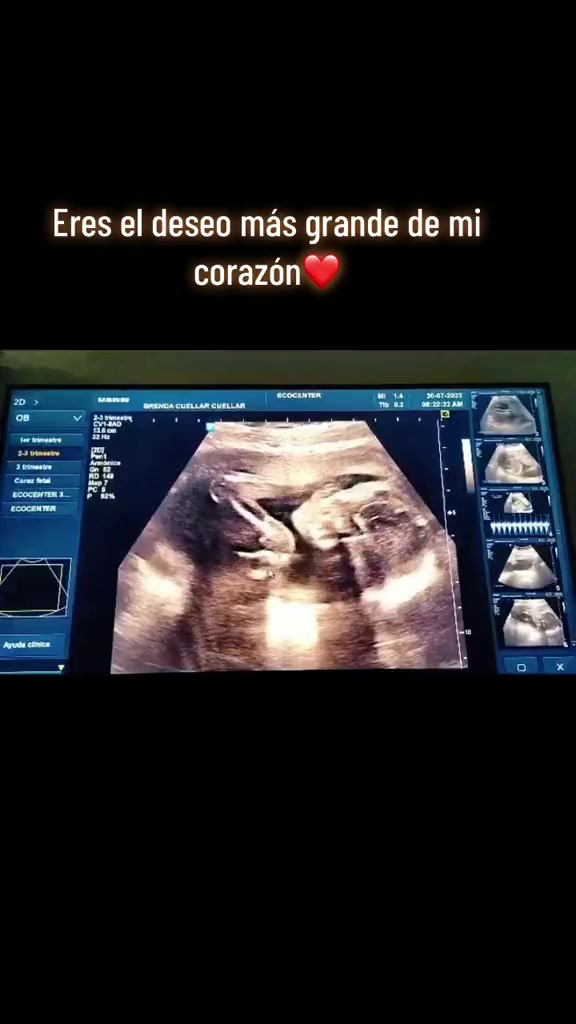 @Brenda Cuellar