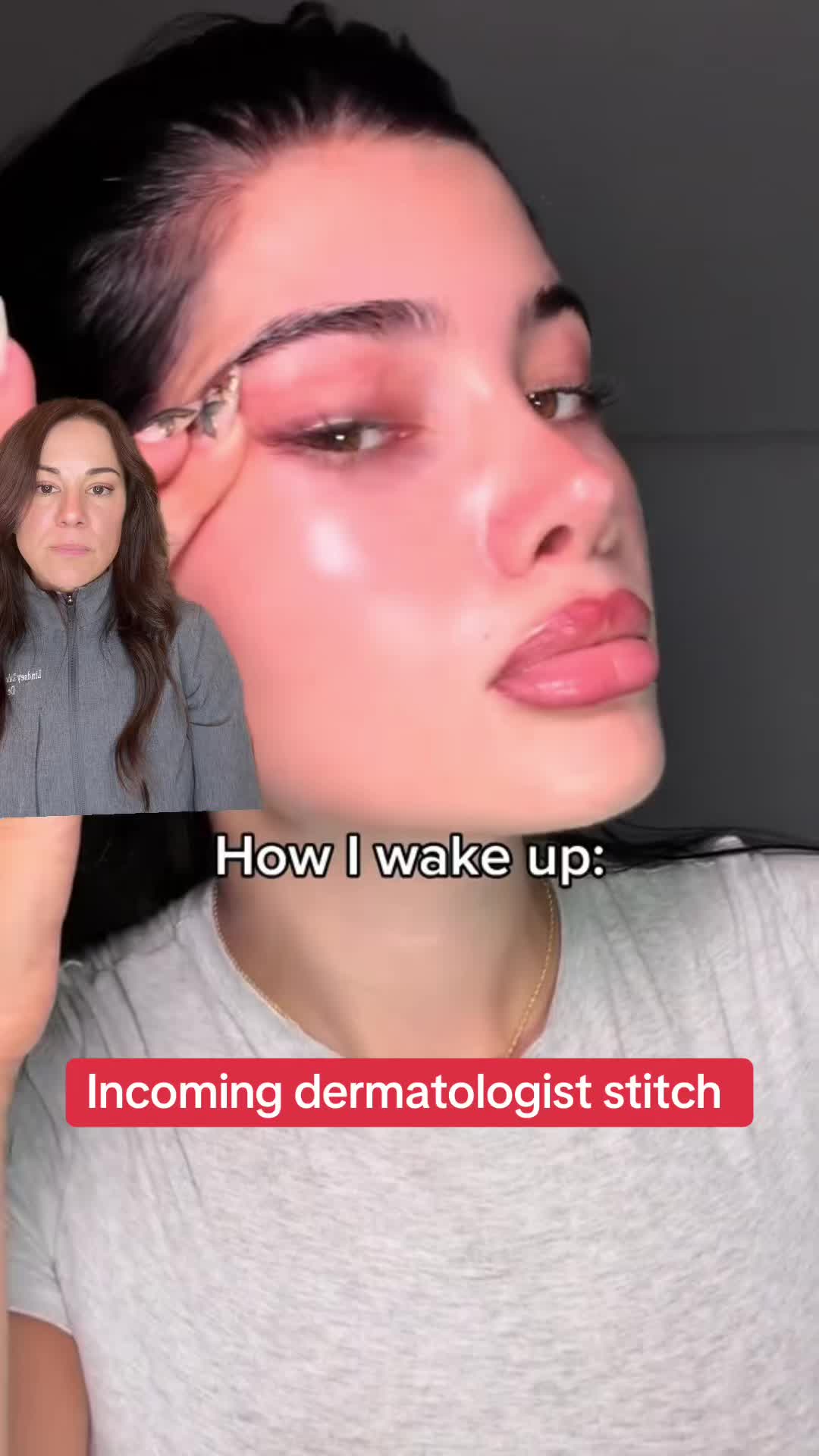 @Dermguru