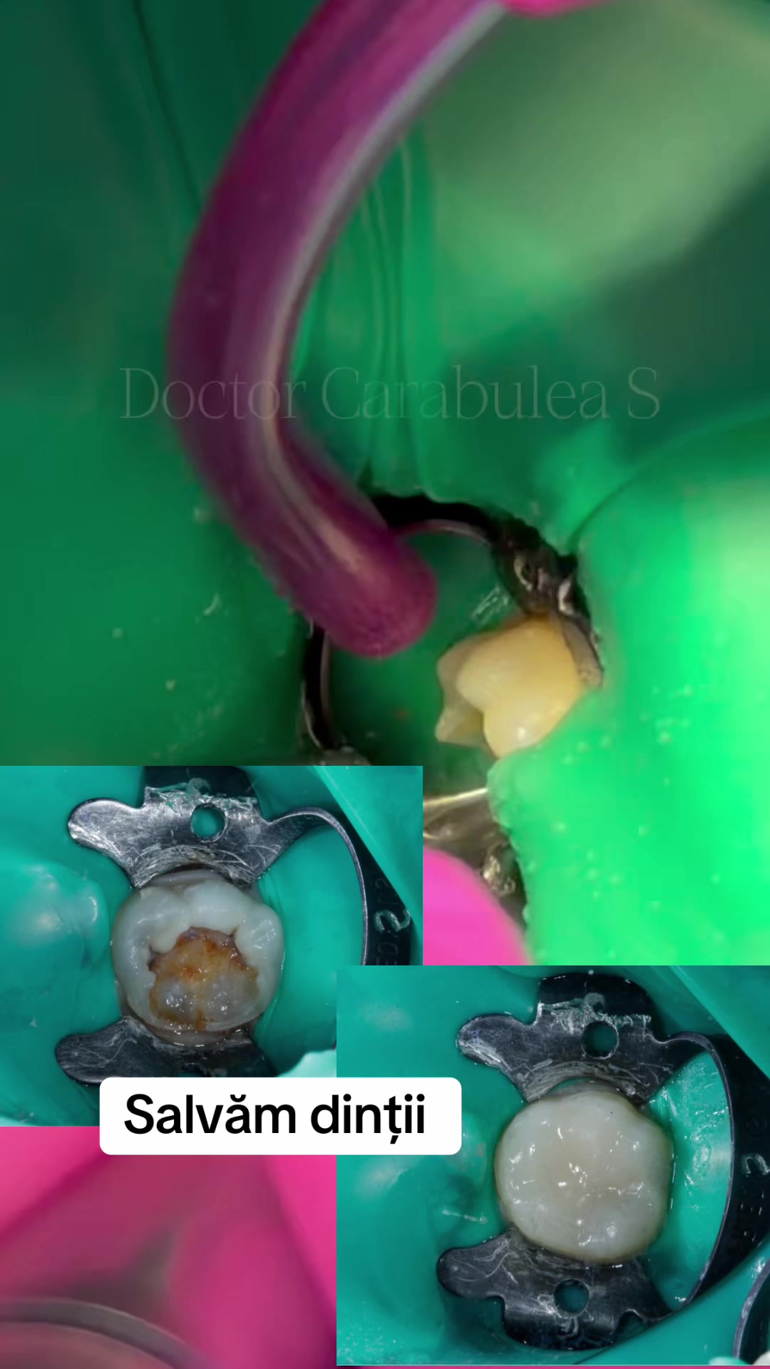 @Stomatolog Snejana Carabulea🦷