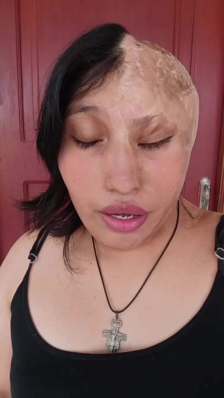 @Elizabeth Carri&oacute;n