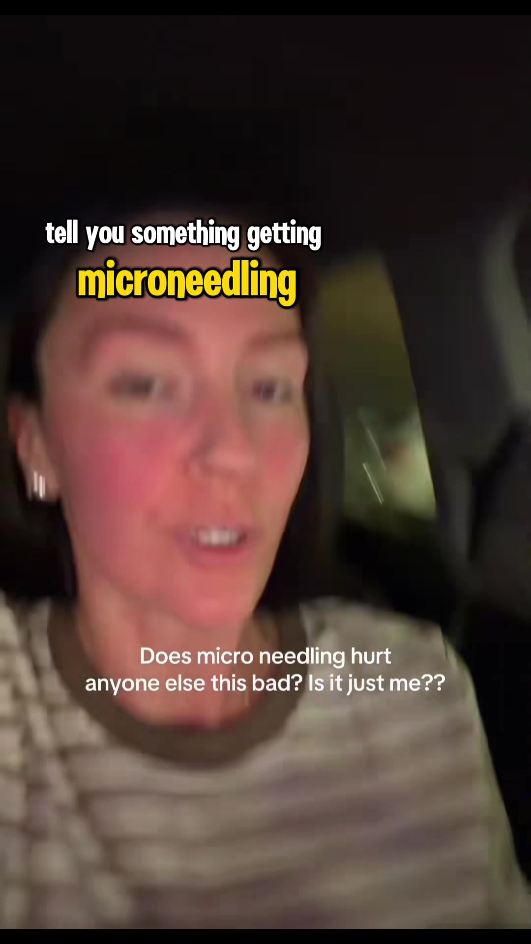 @Pure Skin OC