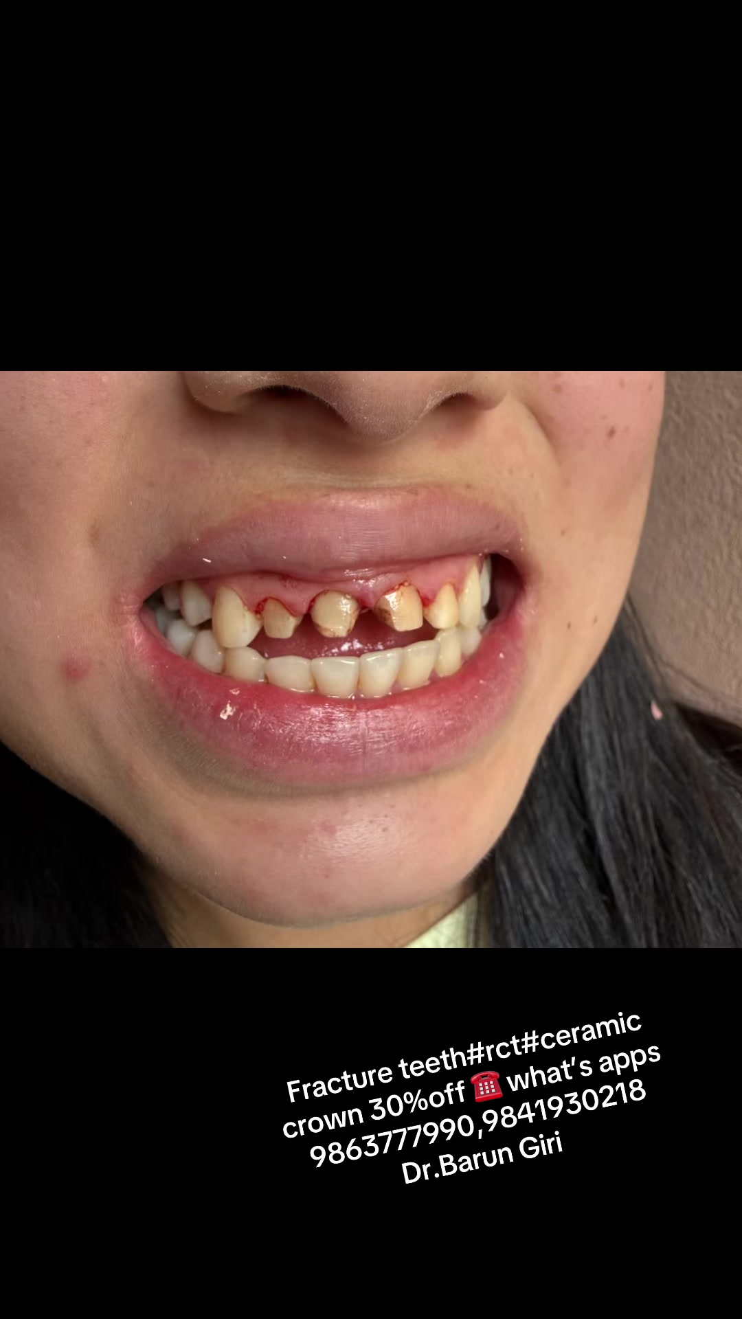 @Unique dental clinic Chabahil