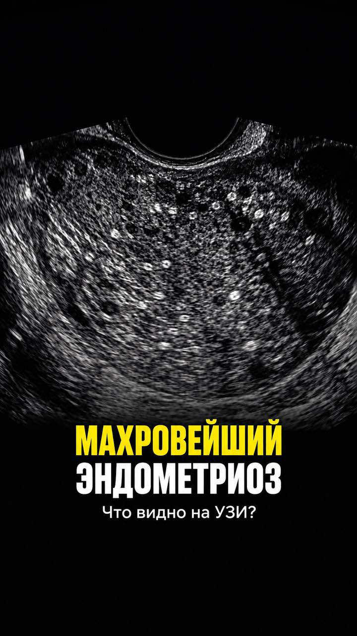 @Гинеколог Москва