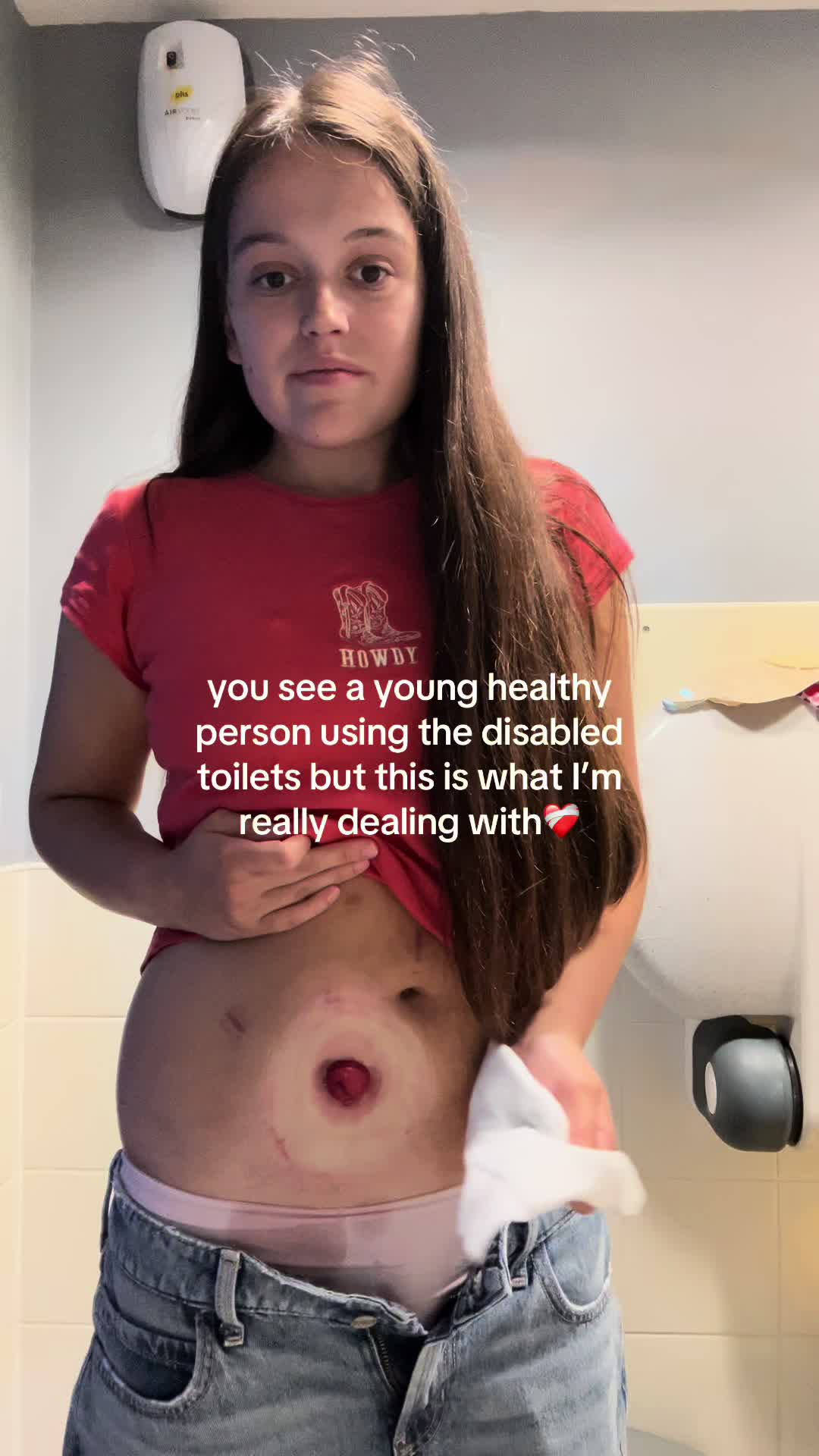 @tonisbrokenbladder