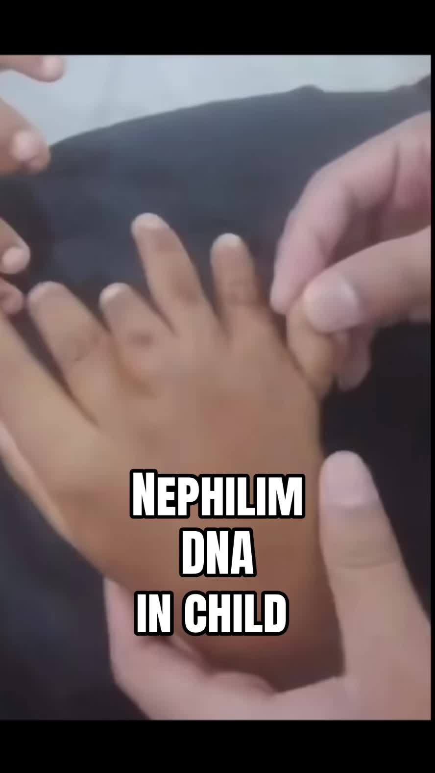 @Clepto
