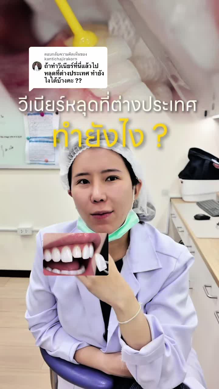 @หมอป่องสวยมาก veneer 🦷