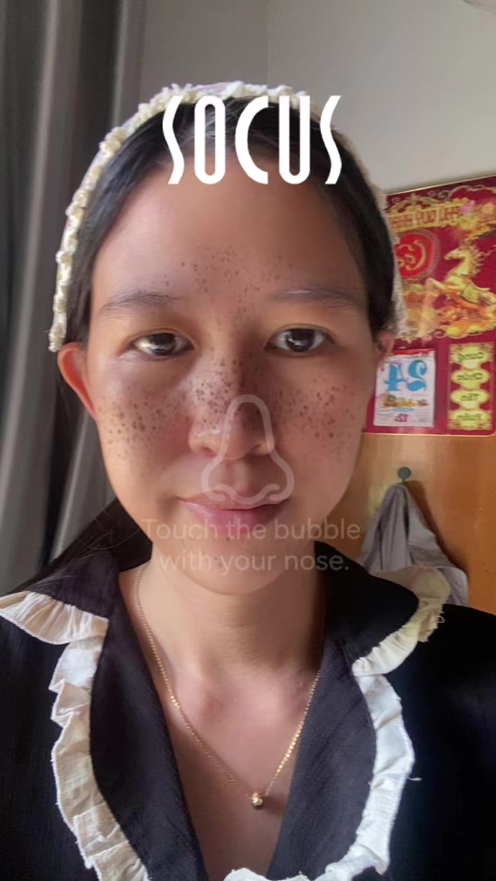 @Ebe chữa l&agrave;nh