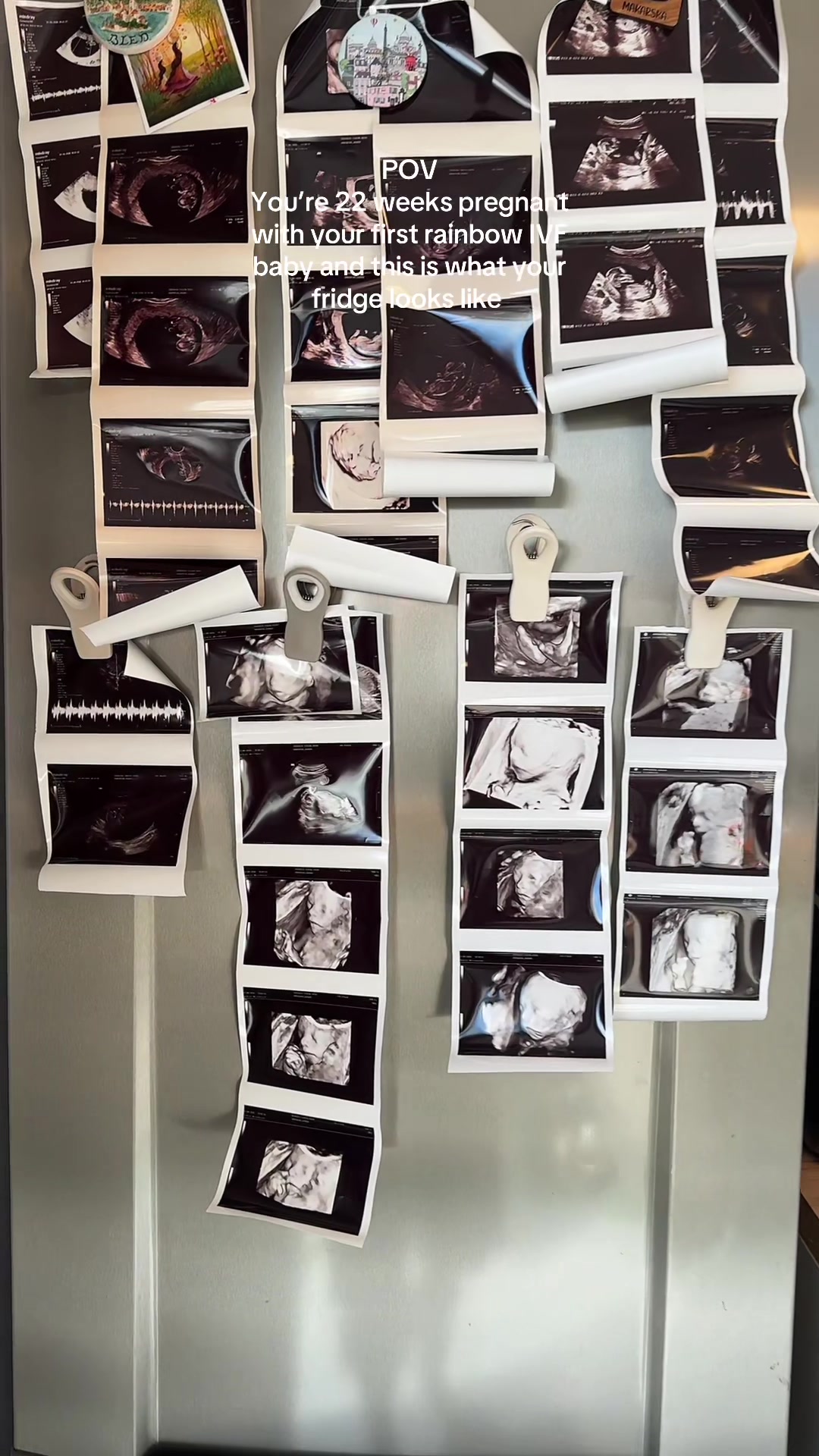 @jdmowski_ivf