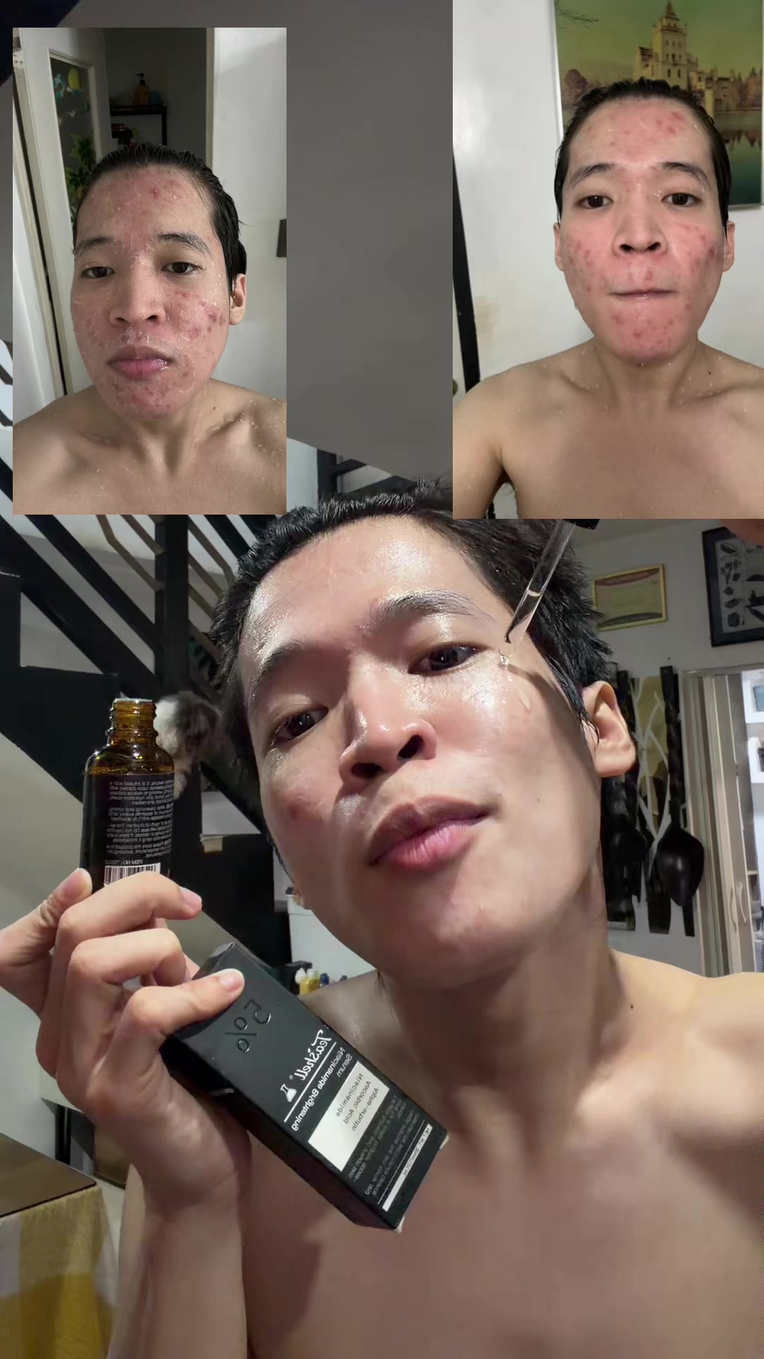 @marvin isanan
