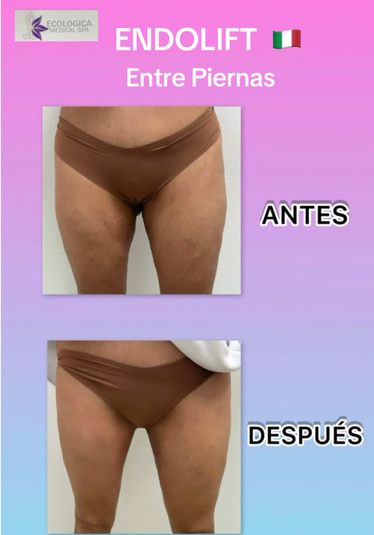 @Ecologica Medical Spa