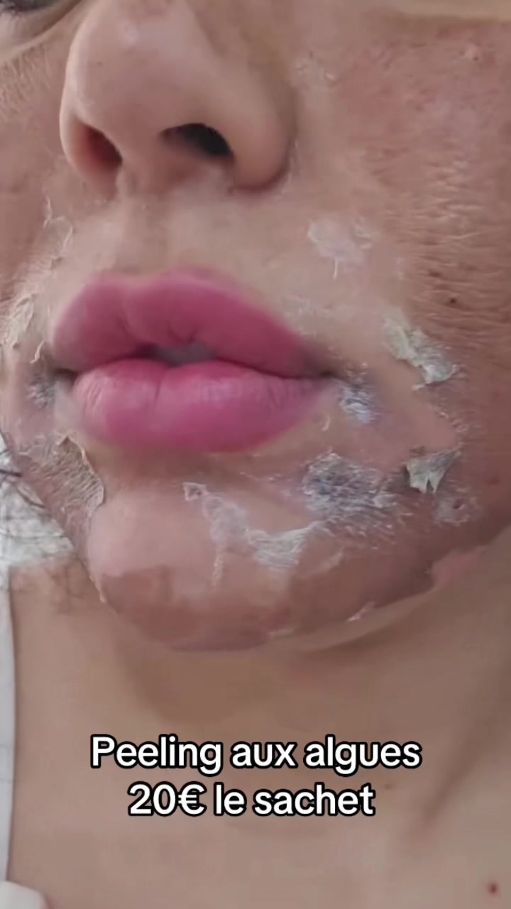 @peeling_zena