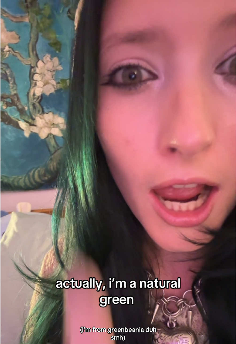 @Au/Ra