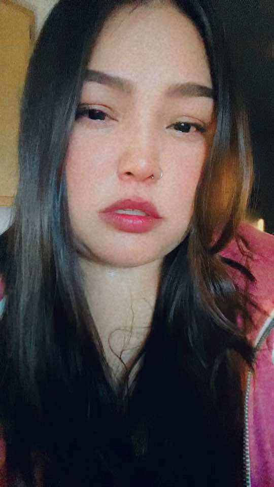 @๐ซถ๐ผ