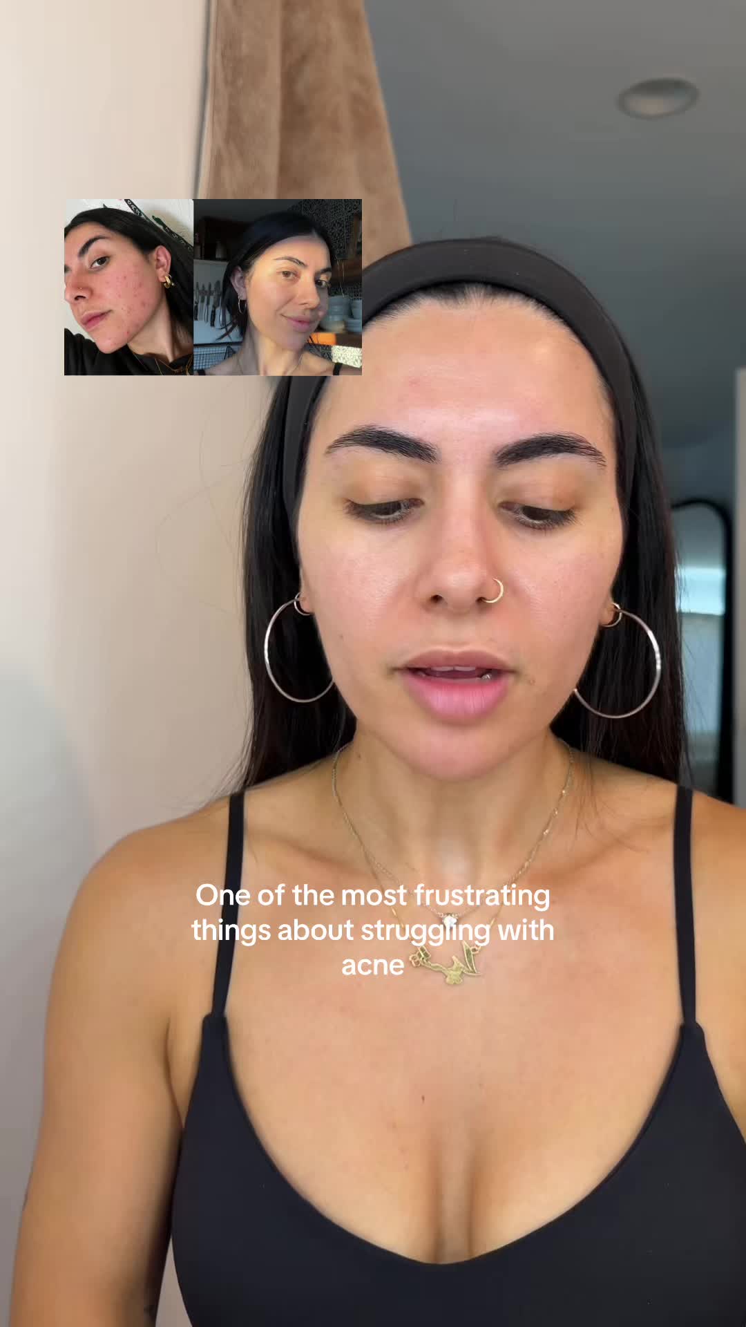 @Doctor Sheyda | Acne Expert