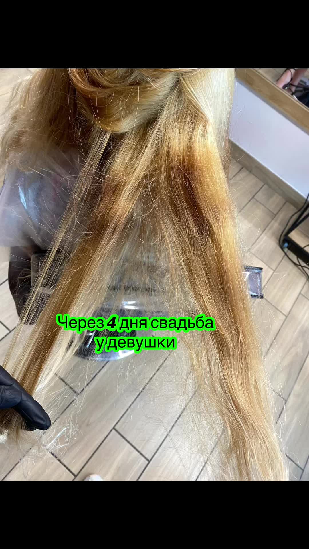@ANNA