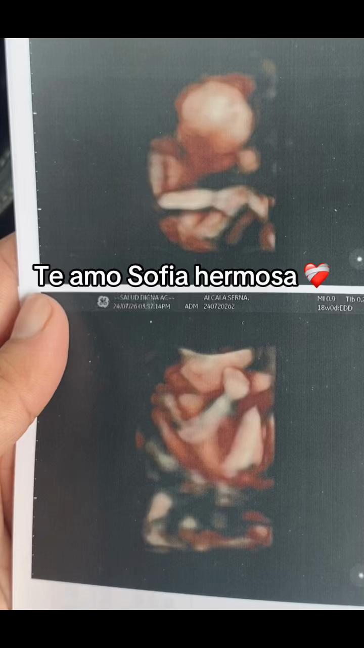 @Liz Alcala