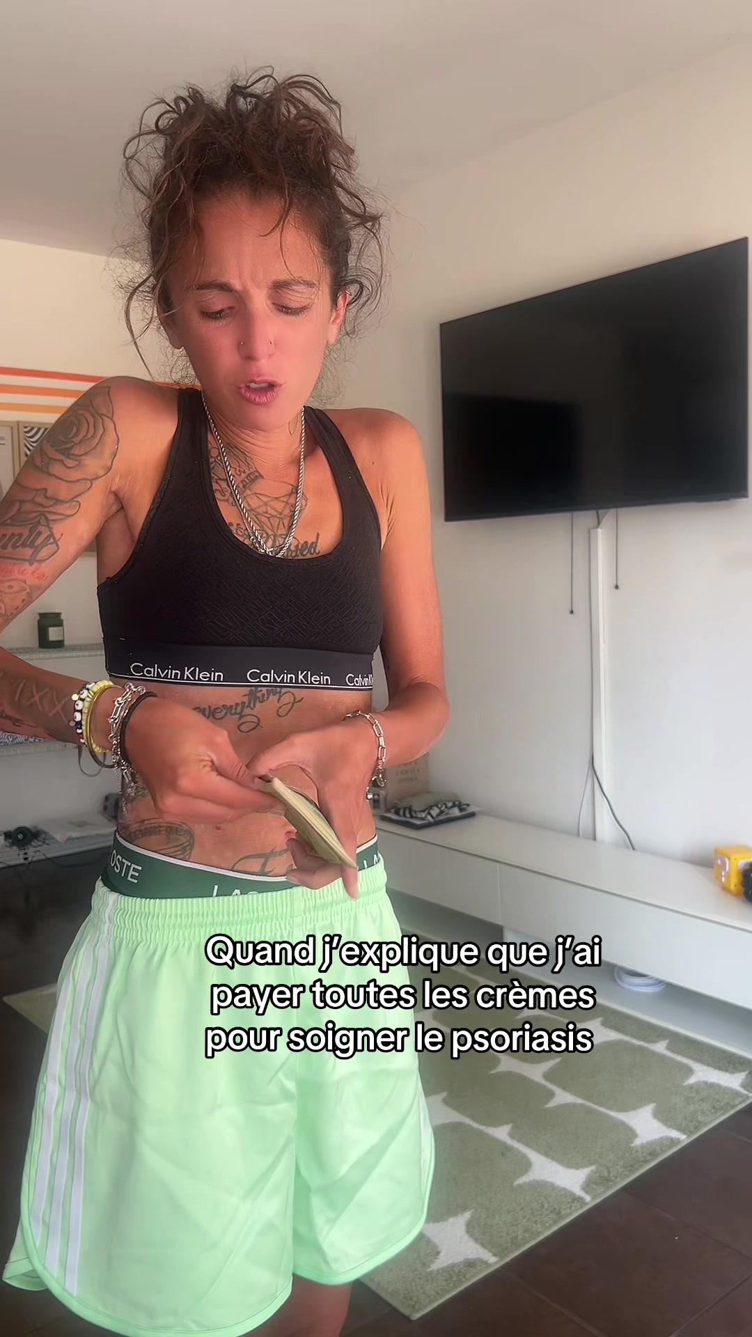 @lyla_psoriasistyle