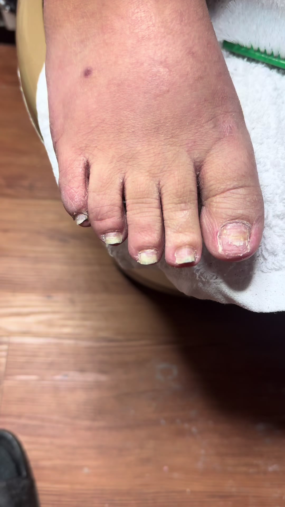 @ToesbyKoki