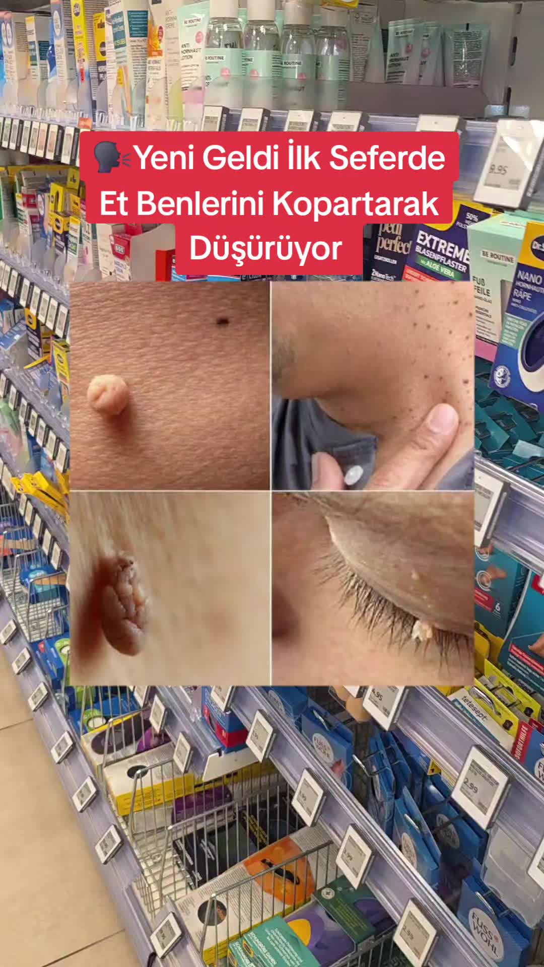 @Gurbetana27