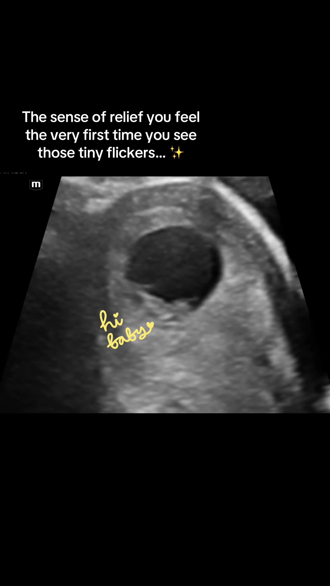 @babyspace3d4d