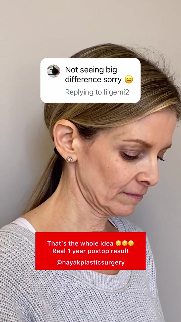 @NayakPlasticSurgery